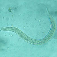 Hookworm rhabditiform larva