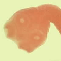 T. saginata scolex