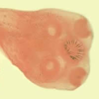 T. solium scolex