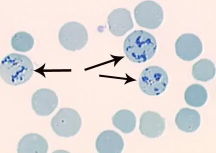 Reticulocyte