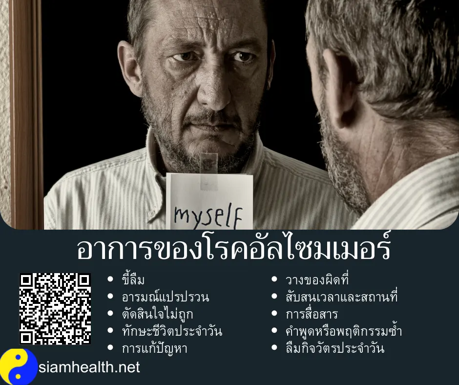 อาการโรคอัลไซมเมอร์